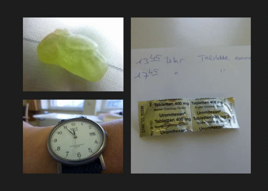 1. Chemo